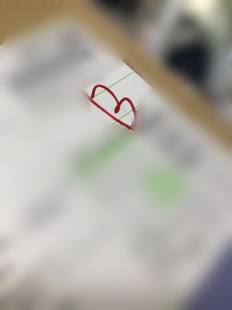 佐川急便から宅配物が届いたのですがこの"B”とはどういう意味ですか？？
因みにAmazonで注文していたものです。 