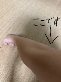 腕の肘がこんな感じでへこんでるような感じなんですけどここって太くできないんですか？ 最近筋トレを毎日続けていて普通にしてると腕はだんだん筋肉ついてきているのですが、腕を伸ばしたまま肩を内側に入れると肘がこのように細いんですよ