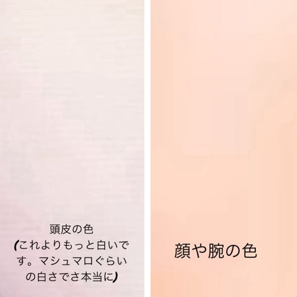 至急！肌を白くする方法を教えてください！ 最近、鏡を見るときにふと思ったのですが頭皮は白いのに顔が薄い小麦肌なので前髪を上げた時など頭皮が白い色が違うのが明らかに分かり悩んでいます。ちなみに私はもともと肌が白い方だとは思っています。顔、腕、味足の日に当たらない箇所に関しては頭皮と少し同じくらいの色をしています。真っ白ではないですが日に当たってる箇所よりは断然色が違います。現在はビタミン(リポスエイド)を飲み始め2週間ほど経ちましたが少し顔が明るくなったかな？という感じです頭皮と同じ白さにするにはまだまだ掛かりそうです。肌を白くした人はどんな方法で白くしましたか？内側からケアした方がいいとよく聞くので化粧水やビタミン剤以外で食べ物や生活習慣などで気をつけてること工夫してることがあれば教えていただきたいです。 また、頭皮と顔の色どんな感じか画像載せておきます。よろしくお願いします。