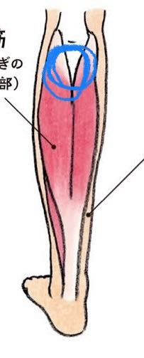 段差のあるところでふくらはぎのトレーニングを2週間空けてしたら、青く塗った部分が2、3日筋肉痛？があります。これって普通でしょうか？毎回痛くなります。