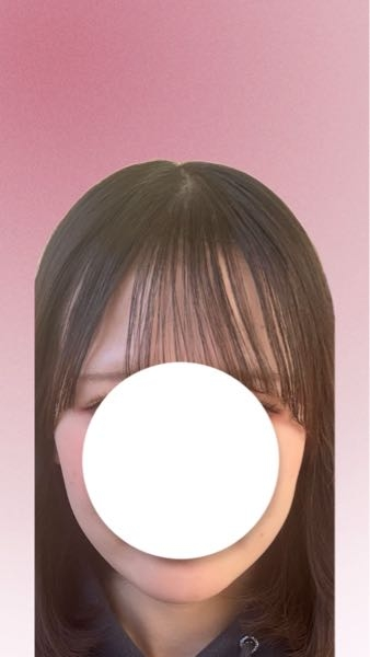 至急 高3女子です。入社前のタイミングで小顔になりたいと本気で悩んでいます。頬の部分のたるみ、丸を帯びている輪郭がコンプレックスな為、痩せる以外で整形を考えています。 湘南美容クリニックでの脂肪溶解注射、糸リフト、ボトックスどれがいいのでしょうか？