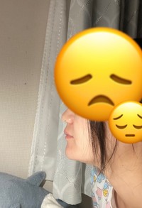 美容整形について質問です。

骨は出ていないのですが、あご肉が出ていて、シャクレているように見えてしまいます。
すごくコンプレックスなので、口元を隠して笑ってしまうのと 自分に自信がなくて人からどんな風に見られているかいつも気にしてしまいます。
これは骨を切らないとダメでしょうか。