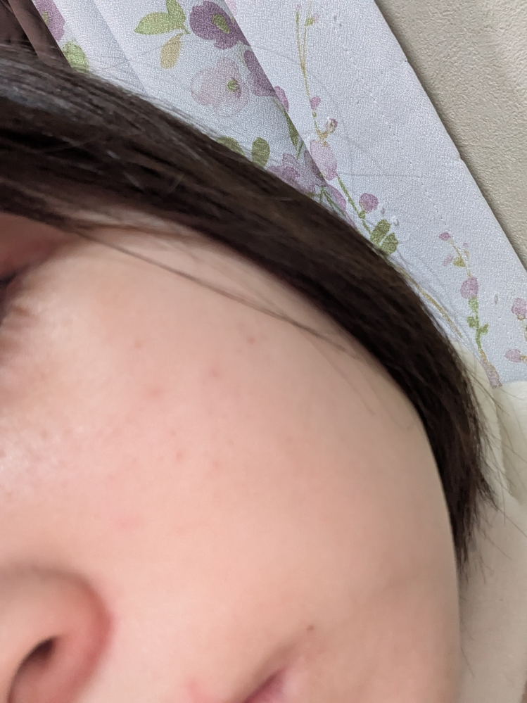 肌荒れがすごいです、ニキビが治ってもすぐできてしまいます、夏頃からバイトを始めるので、それを機にスキンケアの見直しをしたいと思っています！ 近くで見ると毛穴の黒ずみや、ニキビが目立ってしまいます、今使っているスキンケア用品は、アットノン、白潤、豆乳イソフラボンアイクリームです！洗顔は、スキンライフを使っています！毛穴やニキビが目立たない肌をめざしたいと思っています！プチプラで買える物を教えてください！