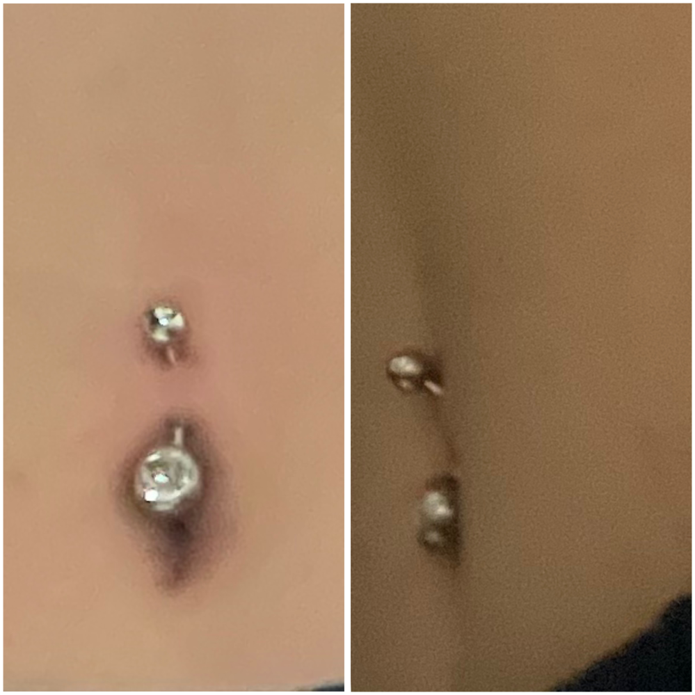 今朝へそピアスをあけたのですがこれは浅いでしょうか？ 初めて開けたため、排除含め少し不安です、、、