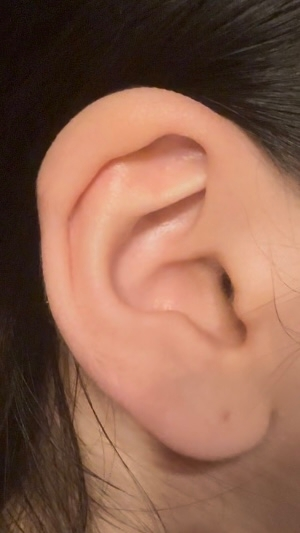 アンテナヘリックスを開けたいのですが、耳の形が変なので似合わないですかね？