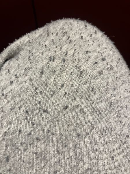 服について質問です。 よく履くズボンなのですが 画像のようになっています。 これはどういったものなのですか？ 対処法なども教えてください。