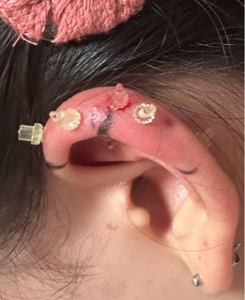 シャネルのピアスについて - 片方だけ刻印があり片方だけ刻印が