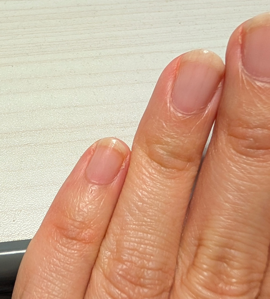 マットジェルが一部なかなか乾かないことがよくあるんですがこれ... - Yahoo!知恵袋