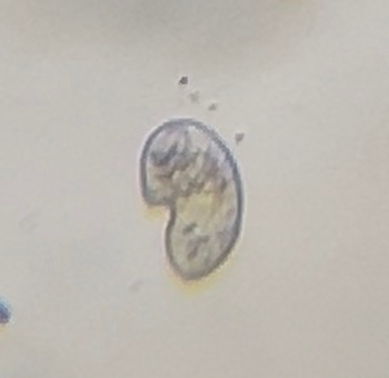 画像が不明瞭ですみません この微生物は何でしょうか ・顕微鏡100倍・淡水水槽 - Yahoo 知恵袋