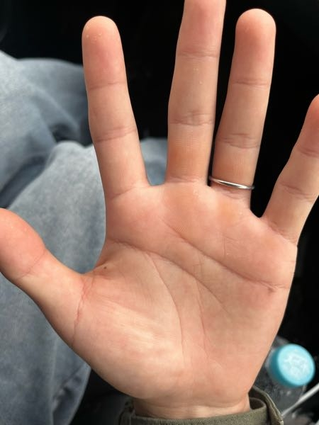 手相を見てほしいです！気になることや、気をつけた方が良いことなどが
