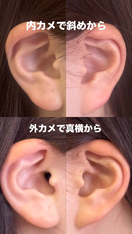 ピアスを両耳に1つずつ開けたいです！！位置のアドバイスお願いします 