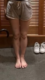 19歳♀です。足が太い事がコンプレックスです。。。足が細くなる方法を