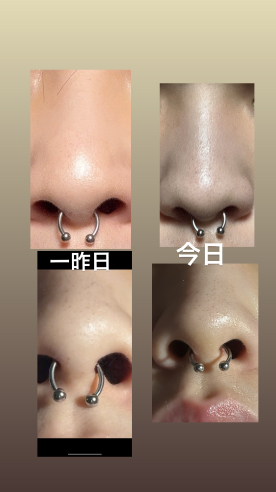 セプタムピアスを開けようと思うのですが、ファーストピアスはリング状 