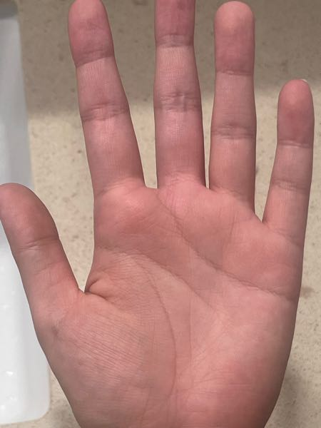 23歳女性です。23年間という短い間ですが、色々ありました。手相見て