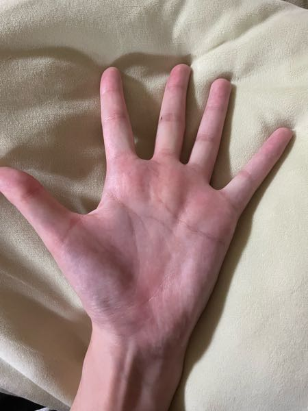 手相に詳しい方にお伺いしたいです。 - 左手の生命線が短いです。右手