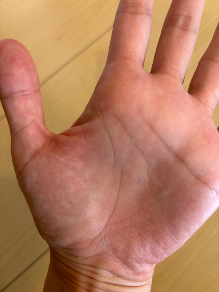 手相について質問です。昔から生命線がとても短く切れているので不安