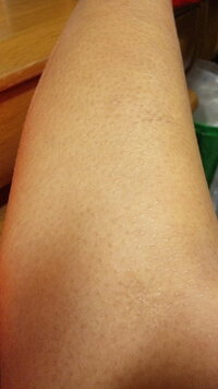 ムダ毛処理について質問です 私は毎日お風呂に入ったら足のムダ毛を剃刀 Yahoo 知恵袋