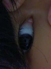 目頭あたりに変なものが 画像では見にくいですが 反対の目と比べると目頭の中 Yahoo 知恵袋