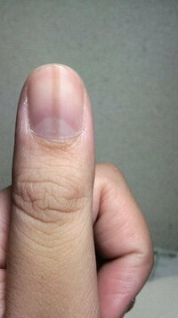 爪の茶色の縦線について 物心ついた時から左手親指の爪に茶色っぽい縦線が入っ Yahoo 知恵袋