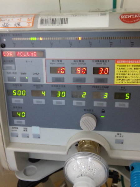 脳出血で意識不明になり2ヶ月の父の人工呼吸器です なかなか看護師さんにも聞きに Yahoo 知恵袋