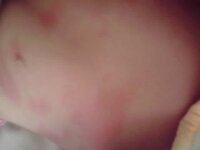 ９ヶ月の赤ちゃんに赤い斑点１０分くらい前にお腹と脇の下に大きな赤い斑点が出まし Yahoo 知恵袋