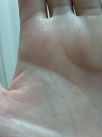手相が分かる方 いらっしゃいましたらどうか助言をお願いします 手に三角紋がくっ Yahoo 知恵袋