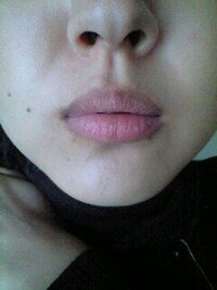 唇が荒れて荒れて もともと敏感肌ですが 今朝起きたら 唇かさかさ 皮も剥けて Yahoo 知恵袋