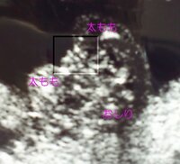 胎児の性別はどちらでしょうか 16週でのエコー写真です 先生は 女の子の確率の Yahoo 知恵袋