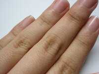 手の甲にシワが多いのがコンプレックスです 友達はみんな綺麗な手な Yahoo 知恵袋