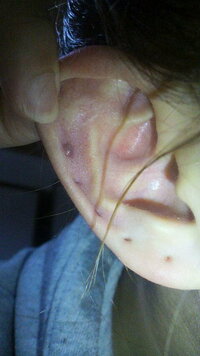 ピアスホールに黒い塊がついてたんですが 垢ですか 痛くはありま Yahoo 知恵袋