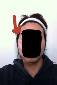 画像あり 顔が左右の頬骨辺りが違います 原因と改善策を教えてください Yahoo 知恵袋