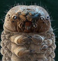 超閲覧グロ注意 この画像はなんの生物の拡大したのですか 気になって眠れ Yahoo 知恵袋