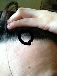 頭皮に白いもの乾燥 わかりにくいですが 頭皮 髪の生え際部分に白い皮 が Yahoo 知恵袋