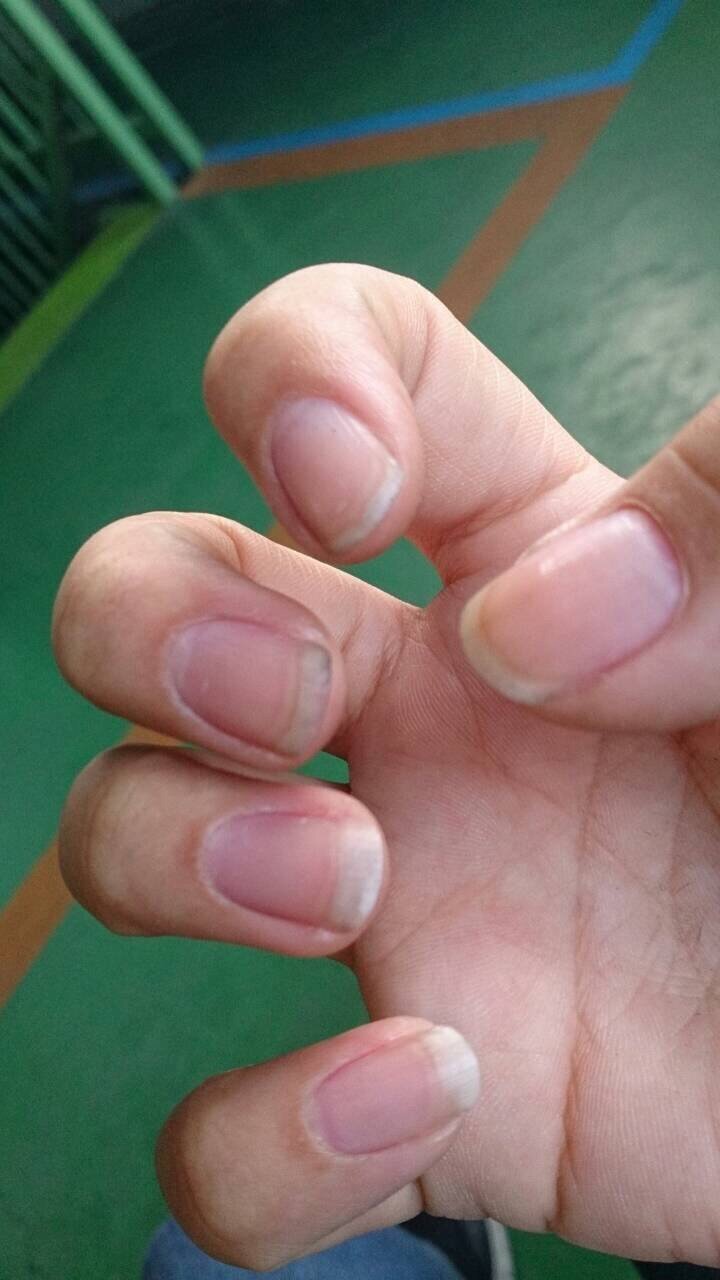 今週末のネイル検定にうけます 3級です モデルはもちろん決ま Yahoo 知恵袋