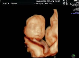 妊娠8ヶ月の妊婦です 先日の検診の時に3dエコー写真に写った Yahoo 知恵袋