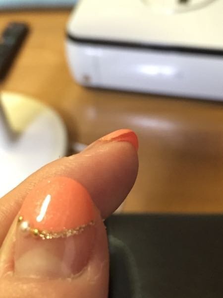 ネイルを初めてしました 爪と指の隙間が無くなってしまっ Yahoo 知恵袋