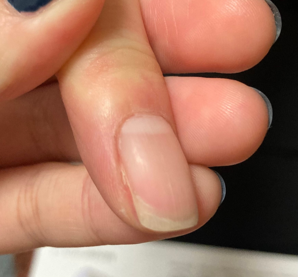 ネイル検定二級についてです １７日の日曜日に受ける予定なので Yahoo 知恵袋