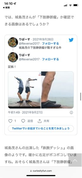 Tokioの城島茂の右足って怪我ですかね 血管の浮き上がりだ Yahoo 知恵袋