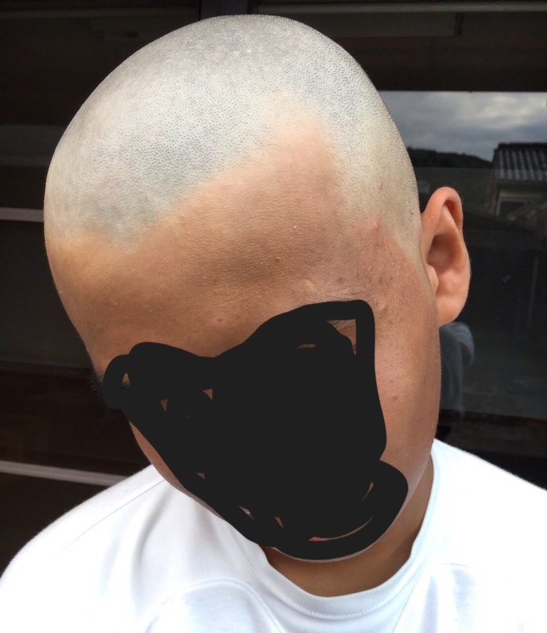 友達達との罰ゲームでスキンヘッドになったのですが 意外と恥ずかしく早く Yahoo 知恵袋