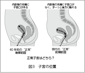 産婦人科で検診をしてもらったときにお医者様から言われました Yahoo 知恵袋