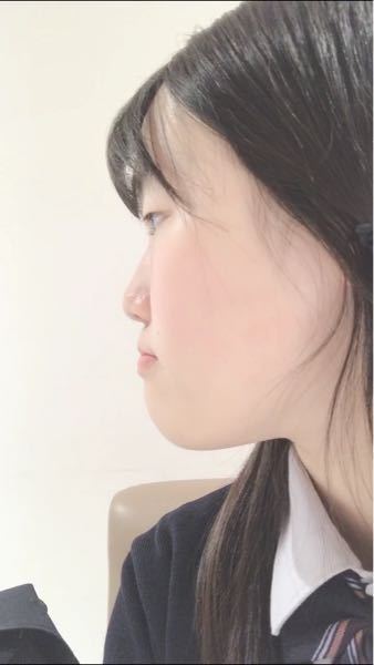 自分の横顔が汚すぎます どこから整形すればいいですか 二重は高校卒業した Yahoo 知恵袋
