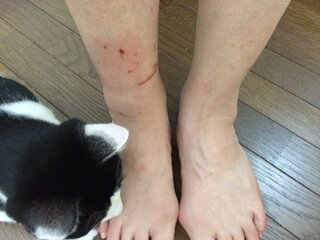 至急 飼い猫に思い切り噛まれました 閲覧ありがとうございます 窓 Yahoo 知恵袋