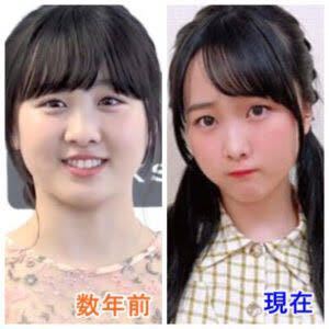 10キロ落とすことに成功したら以前の痩せていた頃と同じ顔の形は無理でも Yahoo 知恵袋