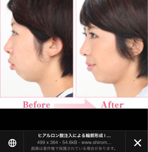 お見苦しい画像ですみません 横顔が小さい頃からコンプレックスです Yahoo 知恵袋