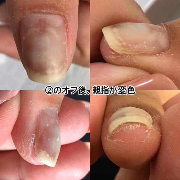 ネイリストです 歴9年目ですが2級取得後 5年間休業 2年前に再 Yahoo 知恵袋