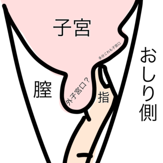 福さん式詳しい方に質問です これは子宮口が開いてると言われますか Yahoo 知恵袋