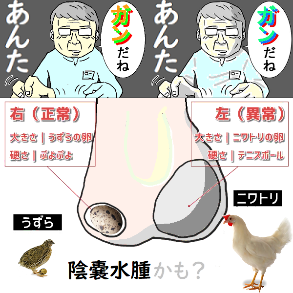 金玉病気の種類 – 睾丸が腫れた – ONYED