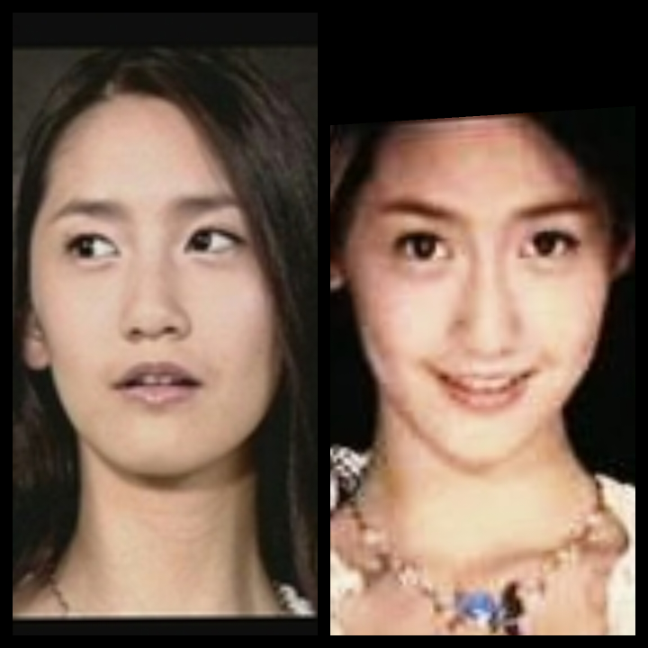 少女時代のユナは 整形してないですよね ユナは以前に整形外科医が選ぶ Yahoo 知恵袋