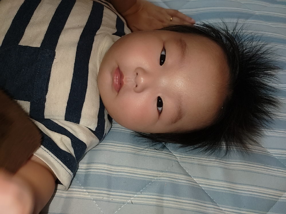 生後4ヶ月の子です フラッシュ撮影してみました 斜視でしょうか 心配 Yahoo 知恵袋