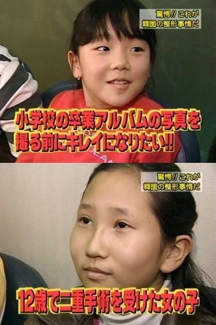 整形してない韓国人の顔の特徴を教えて下さい 整形してない韓 Yahoo 知恵袋